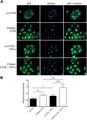 Enhanced Expression of Human Epididymis Protein 4 (HE4) Reflecting Pro-Inflammatory Status Is Regulated by CFTR in Cystic Fibrosis Bronchial Epithelial Cells